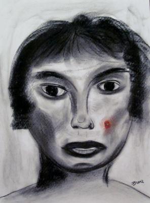 Dame mit Eiterpickel - Juergen Schneider - Array auf Array - Array - Dame mit Eiterpickel - Juergen Schneider - Array auf Array - Array -